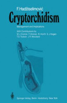 Cryptorchidism: Management and Implications