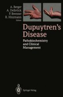 Dupuytren’s Disease: Pathobiochemistry and Clinical Management
