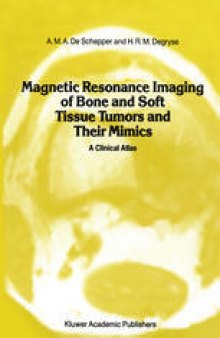 Magnetic Resonance Imaging of Bone and Soft Tissue Tumors and Their Mimics: A Clinical Atlas