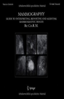 Mammography: Guide to Interpreting, Reporting and Auditing Mammographic Images - Re.Co.R.M. 