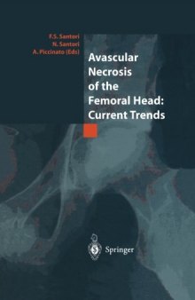 Avascular Necrosis of the Femoral Head: Current Trends