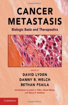 Cancer Metastasis: Biologic Basis and Therapeutics  