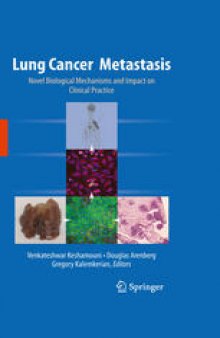 Lung Cancer Metastasis: Novel Biological Mechanisms and Impact on Clinical Practice