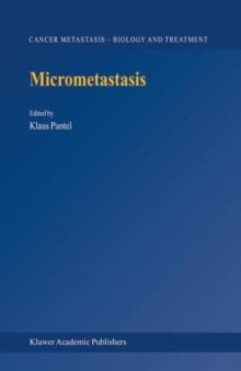Micrometastasis (Cancer Metastasis - Biology and Treatment)