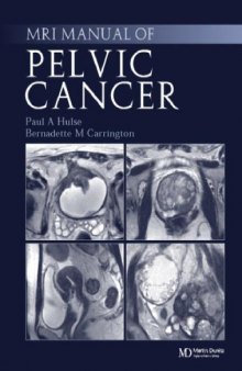 MRI manual of pelvic cancer