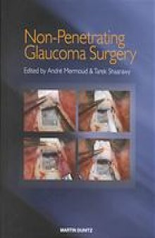 Non-penetrating glaucoma surgery