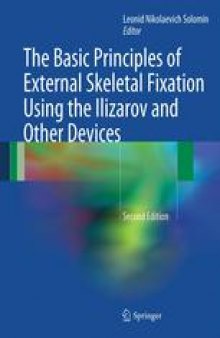 The Basic Principles of External Skeletal Fixation Using the Ilizarov and Other Devices