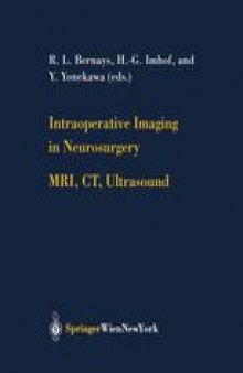Intraoperative Imaging in Neurosurgery: MRI, CT, Ultrasound