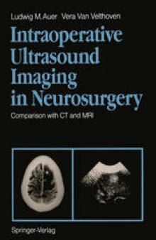 Intraoperative Ultrasound Imaging in Neurosurgery: Comparison with CT and MRI