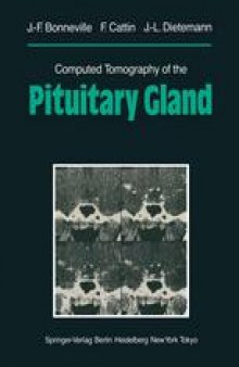 Computed Tomography of the Pituitary Gland: With a Chapter on Magnetic Resonance Imaging of the Sellar and Juxtasellar Region, By M. Mu Huo Teng and K. Sartor