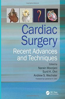 Cardiac Surgery: Recent Advances and Techniques