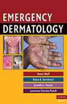 Emergency dermatology