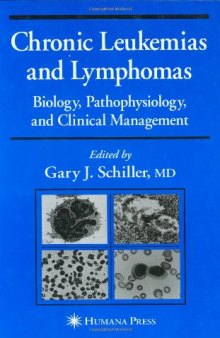 Chronic Leukemias and Lymphomas: Clinical Management (Current Clinical Oncology)