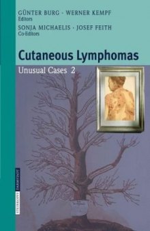 Cutaneous Lymphomas: Unusual Cases