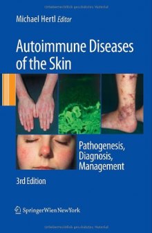 Autoimmune Diseases of the Skin: Pathogenesis, Diagnosis, Management, Third Edition