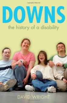 Down's Syndrome: The Biography (Biographies of Diseases)  