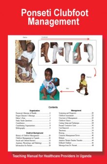 Ponseti Clubfoot Management: Teaching Manual For Health-Care Providers In Uganda