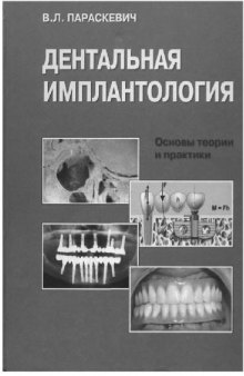 Дентальная имилантология: Основы теории и практики