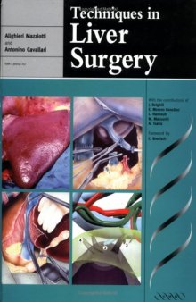 Techniques in Liver Surgery