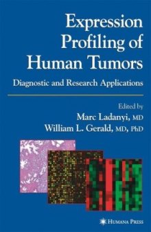 Expression Profiling of Human Tumors: Diagnostic and Research Applications