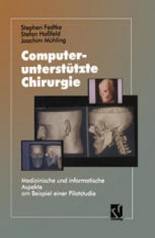 Computerunterstützte Chirurgie: Medizinische und informatische Aspekte am Beispiel einer Pilotstudie