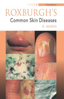 Roxburgh's Common Skin Diseases, 17th edition