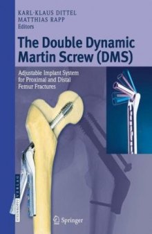 The Double Dynamic Martin Screw (DMS): Adjustable Implant System for Proximal and Distal Femur Fractures