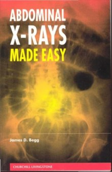 Abdominal X-Rays Made Easy 1st ed