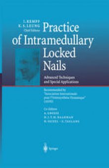 Practice of Intramedullary Locked Nails: Advanced Techniques and Special Applications Recommended by “Association Internationale pour l’OstéosynthÈse Dynamique” (AIOD)