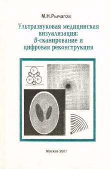 Ультразвуковая медицинская визуализация: сканирование и цифровая реконструкция