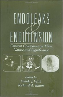 Endoleaks and Endotension: Current Consensus on Their Nature and Significance