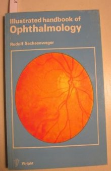 Illustrated Handbook of Ophthalmology