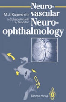 Neurovascular Neuro-ophthalmology