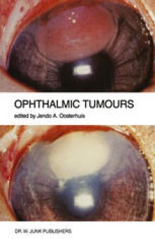 Ophthalmic Tumours: Including lectures presented at the Boerhaave Course on “Ophthalmic Tumours” of the Leiden Medical Faculty, held in Leiden, The Netherlands, on February 2–3, 1984