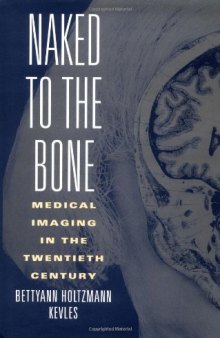 Naked to the bone: medical imaging in the twentieth century