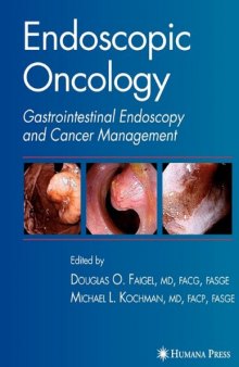 Endoscopic Oncology: Gastrointestinal Endoscopy and Cancer Management