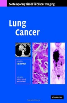 Lung Cancer (Contemporary Issues in Cancer Imaging)
