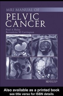 MRI Manual of Pelvic Cancer