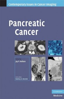 Pancreatic Cancer