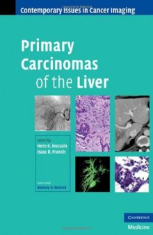 Primary Carcinomas of the Liver (Contemporary Issues in Cancer Imaging)