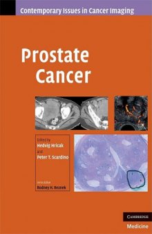 Prostate Cancer (Contemporary Issues in Cancer Imaging)