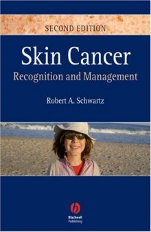 Skin Cancer: Recognition and Management 2nd Edition