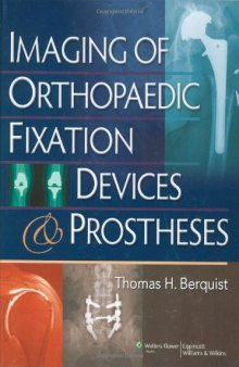 Imaging of Orthopaedic Fixation Devices and Prostheses