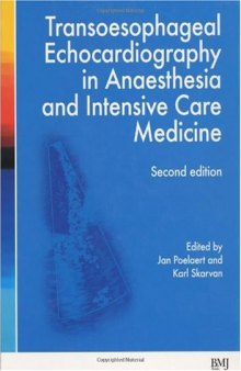 Transoesophageal echocardiography in anaesthesia and intensive care medicine