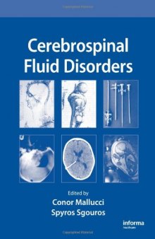 Cerebrospinal Fluid Disorders