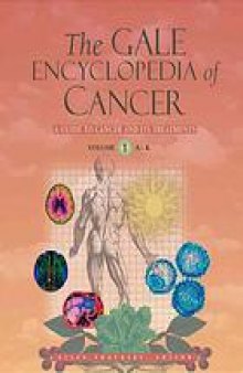 The Gale encyclopedia of cancer : a guide to cancer and its treatment