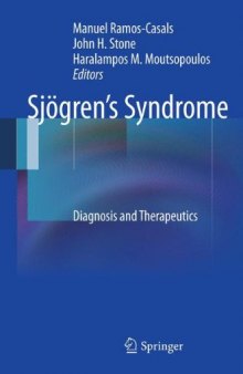 Sjögren’s Syndrome: Diagnosis and Therapeutics