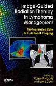 Image-Guided Radiation Therapy and Functional Imaging in Lymphoma Management: The Increasing Role of Functional Imaging
