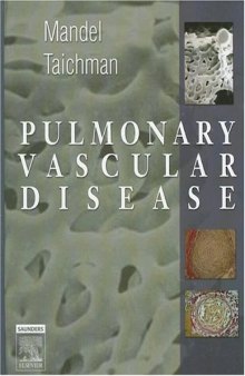 Pulmonary Vascular Disease