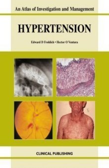 Hypertension: An Atlas of Investigation and Management  